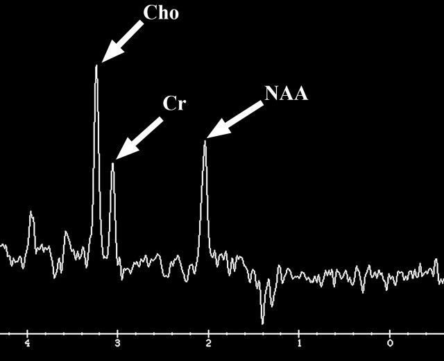 Figure 11g