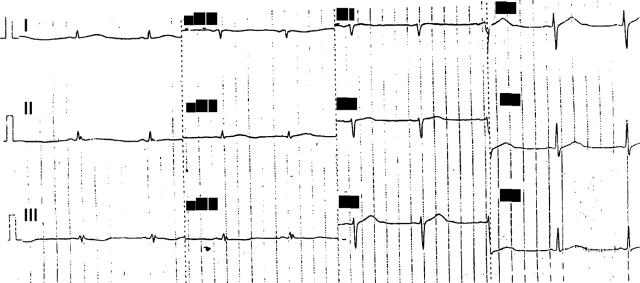 Figure 2  