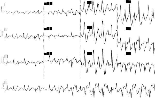 Figure 1  