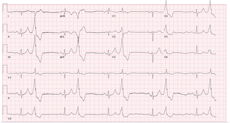 Figure 1