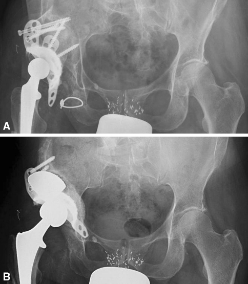 Fig. 3A–B