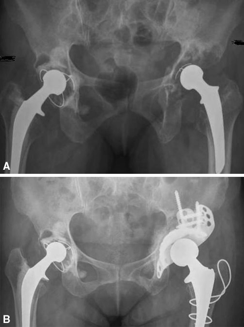 Fig. 1A–B