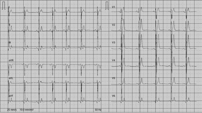 FIGURE 2