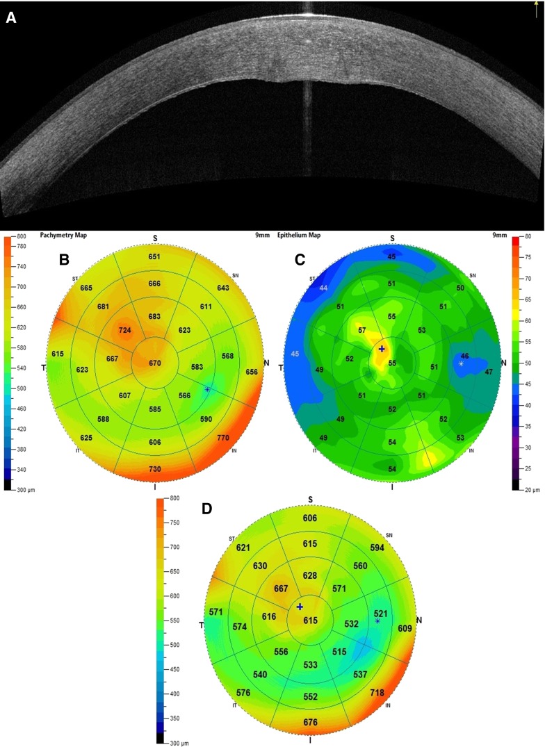 Fig. 2