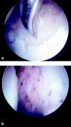 Fig. 10