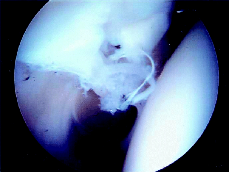 Fig. 4