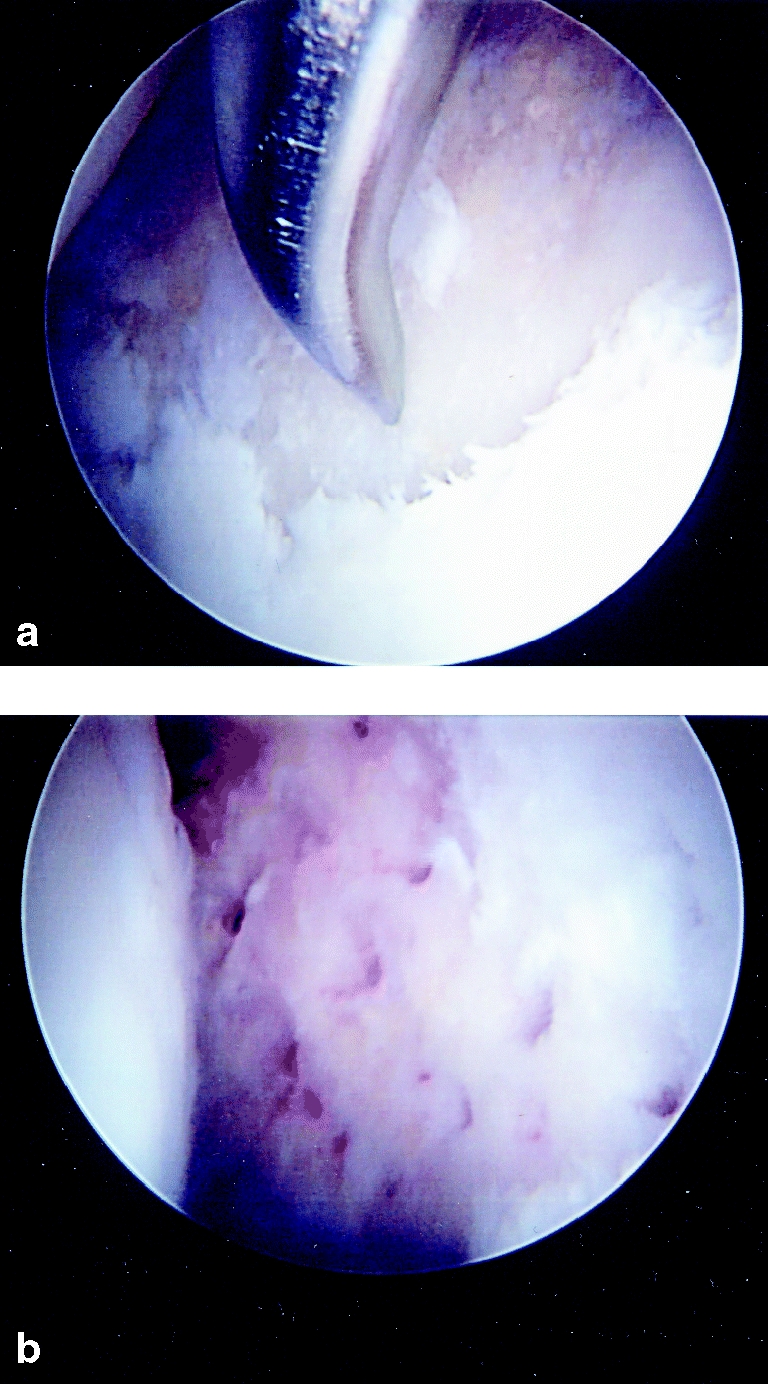 Fig. 10