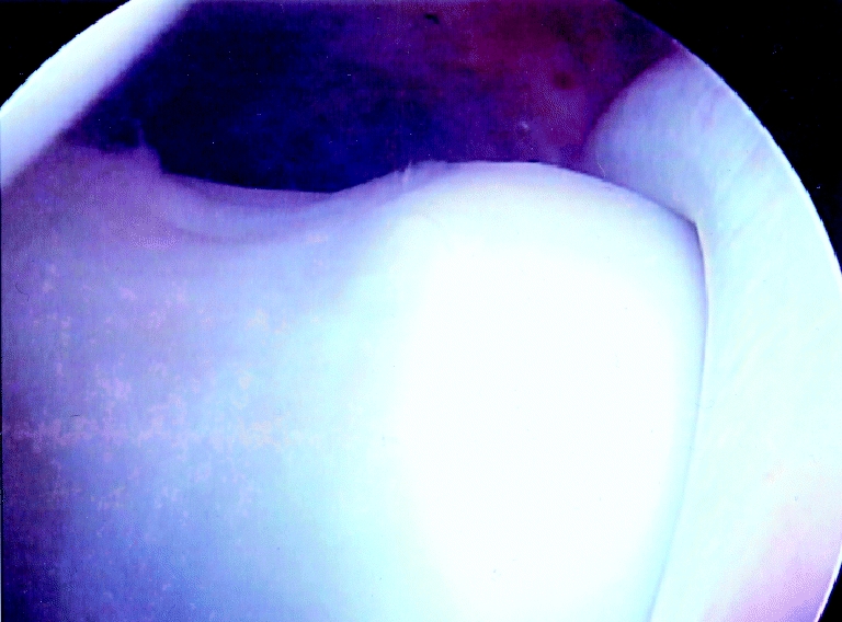 Fig. 5