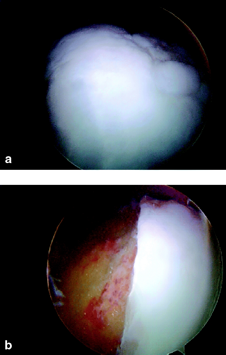 Fig. 9