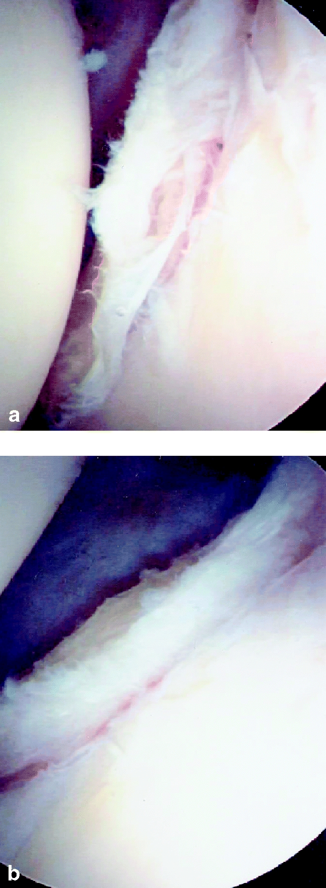 Fig. 6