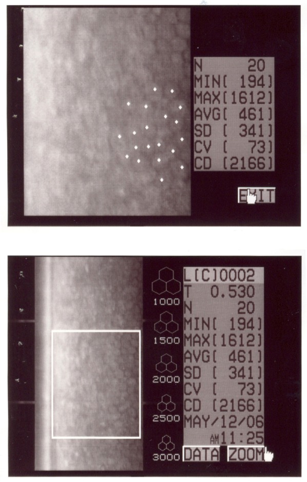 Figure 11