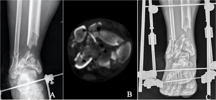 Fig. 1