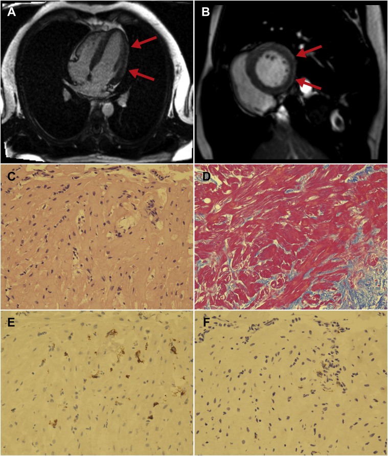 Figure 2