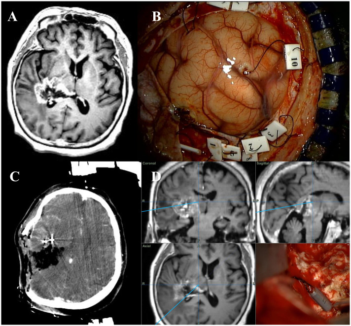 Fig 3