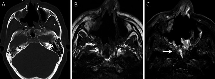 Fig. 12