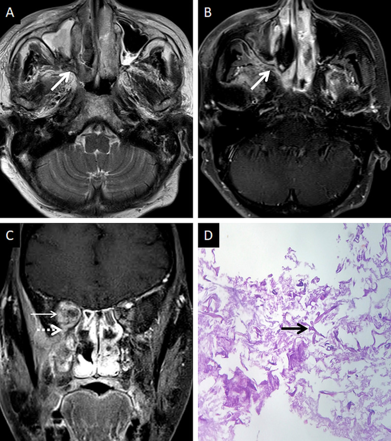 Fig. 10