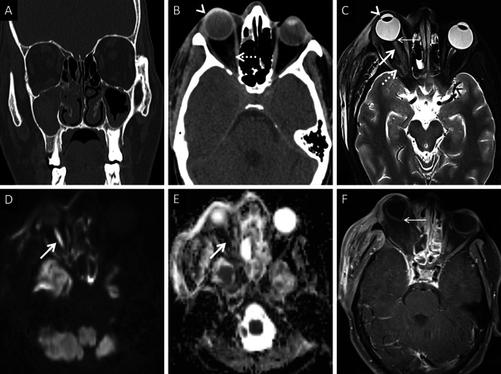 Fig. 14