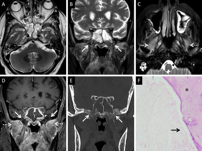 Fig. 11