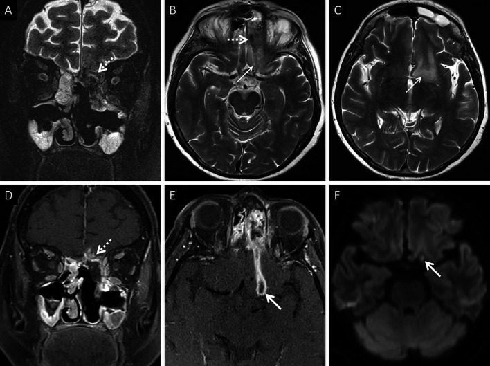 Fig. 15