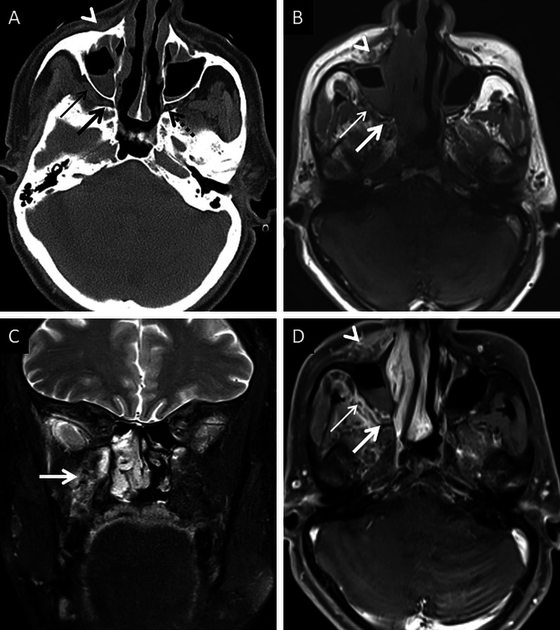 Fig. 9