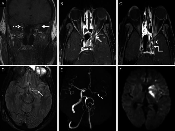 Fig. 17