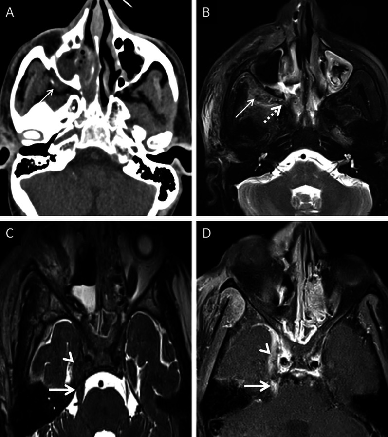 Fig. 16