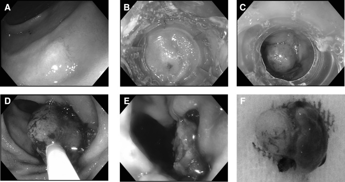 Fig. 3