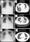 Fig. 1