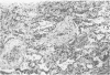200