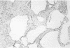 200