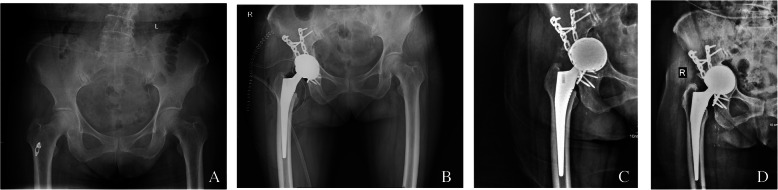 Fig.2