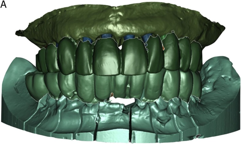 Fig. 9