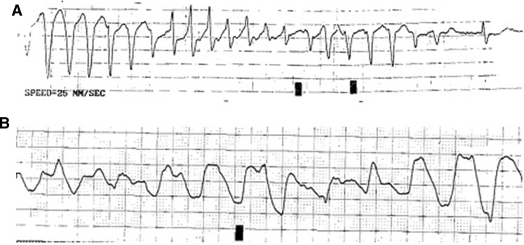 Fig. 1