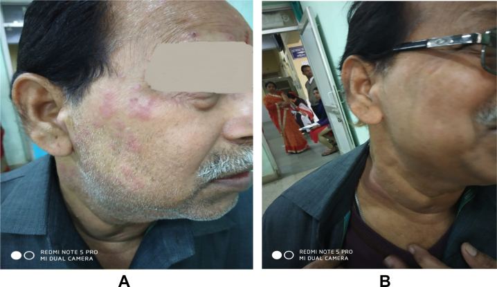 Fig. 2