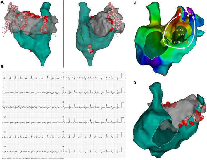 FIGURE 3