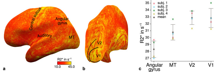 Figure 4—figure supplement 1.