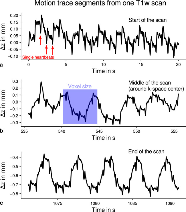 Appendix 5—figure 1.