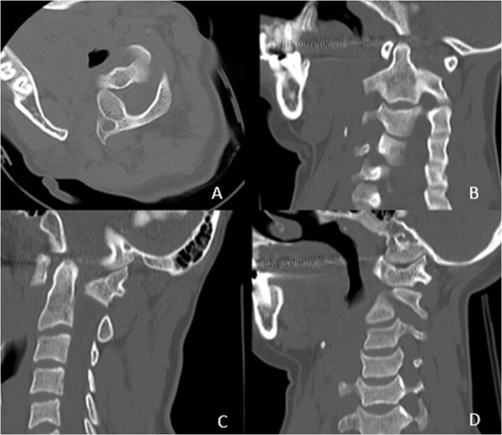 Fig. 2