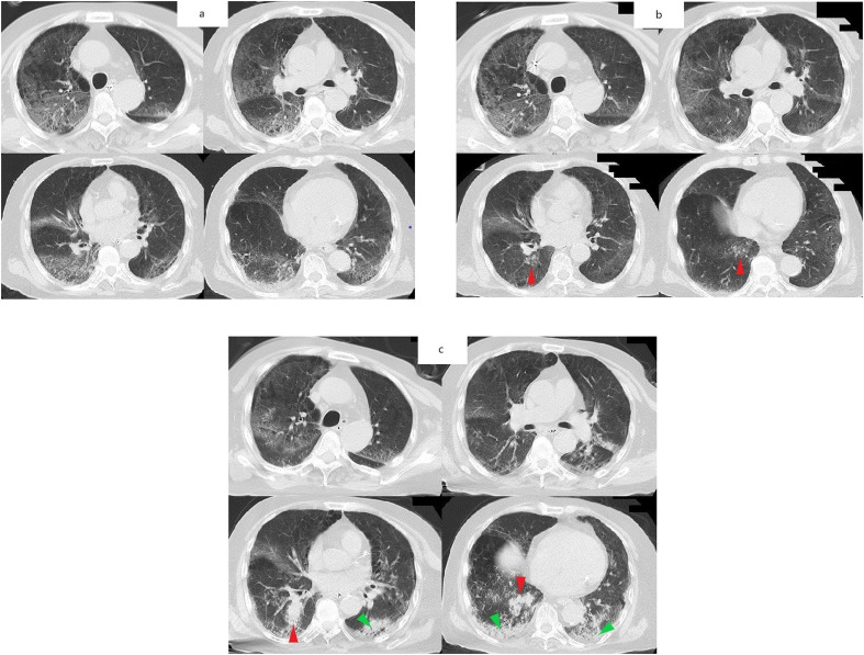 Fig. 1