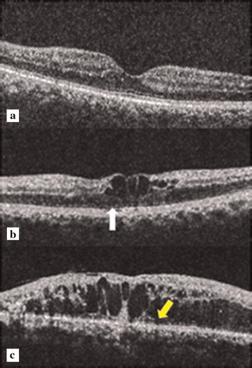 Fig. 1