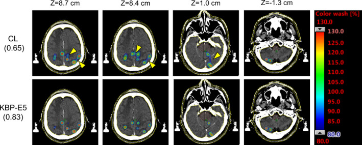 Fig. 4