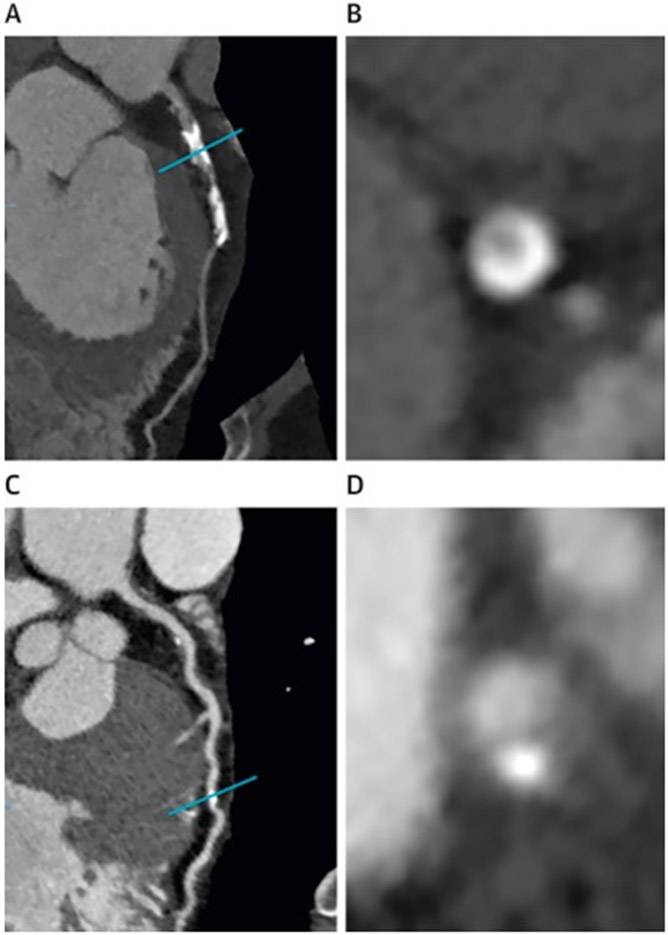 Figure 2: