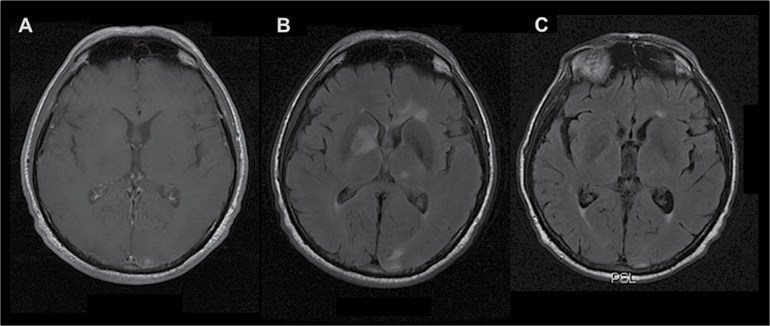 Fig. 2