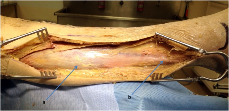 Fig. 10