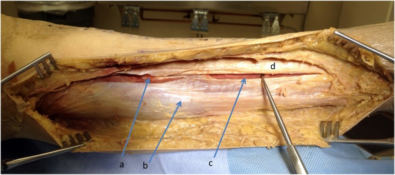 Fig. 11