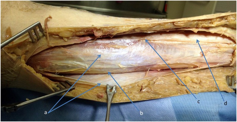 Fig. 14