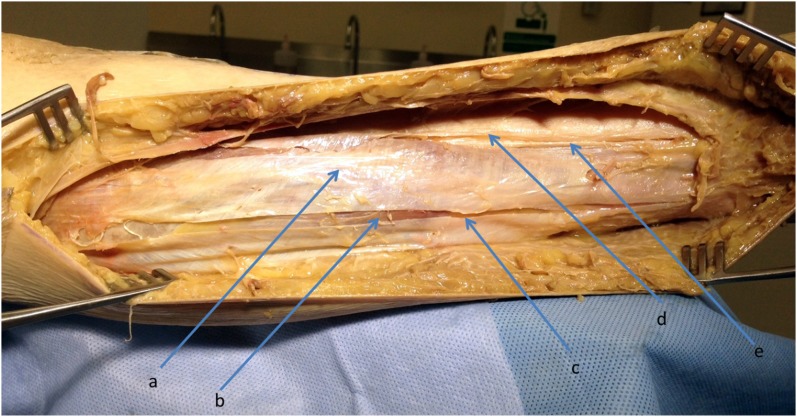 Fig. 13