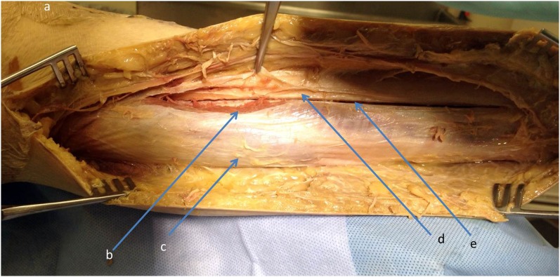 Fig. 12