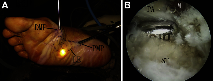 Fig 4