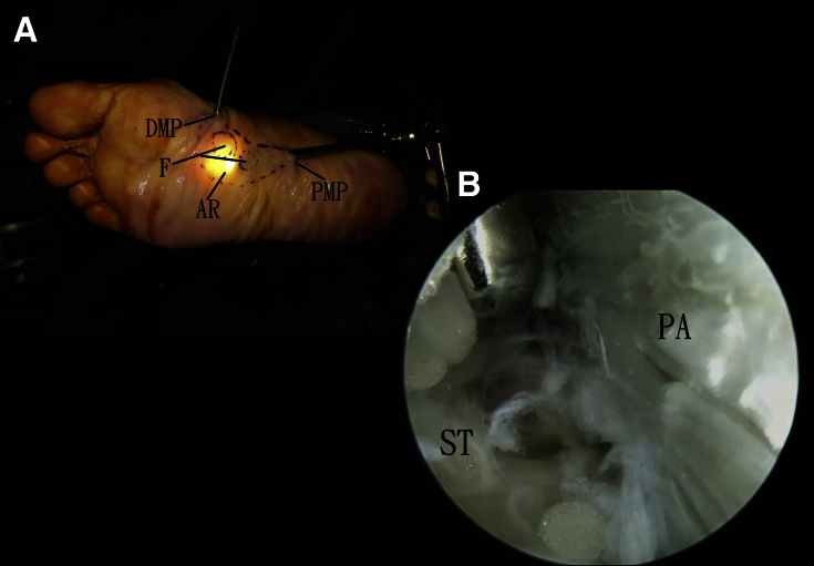 Fig 3